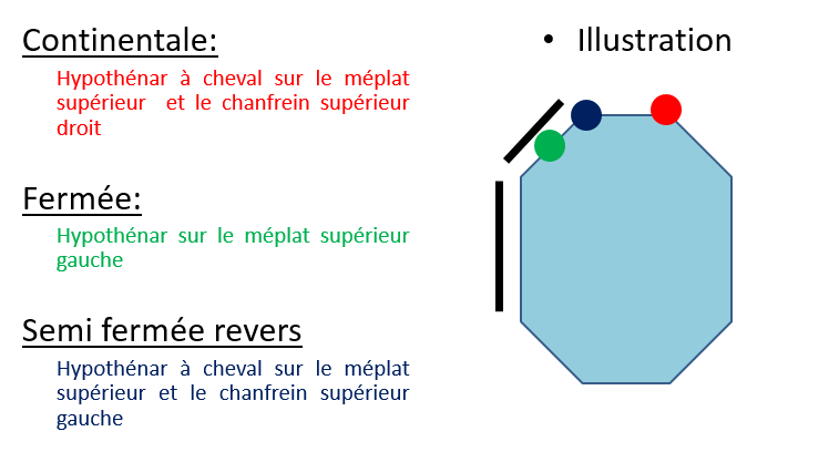 Prises au tennis en revers